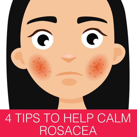 4 Tips to Help Calm Rosacea