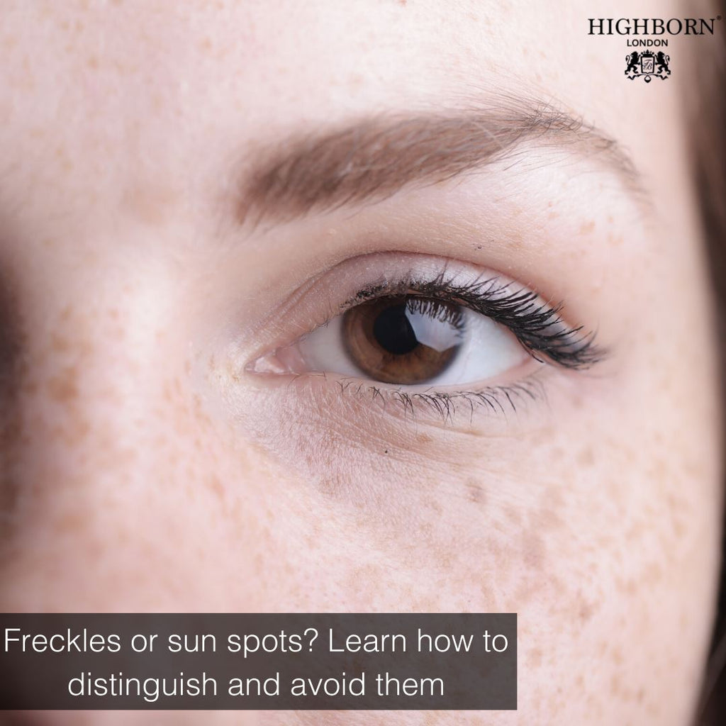 What's The Difference Between Freckles And Sun Spots?: Center